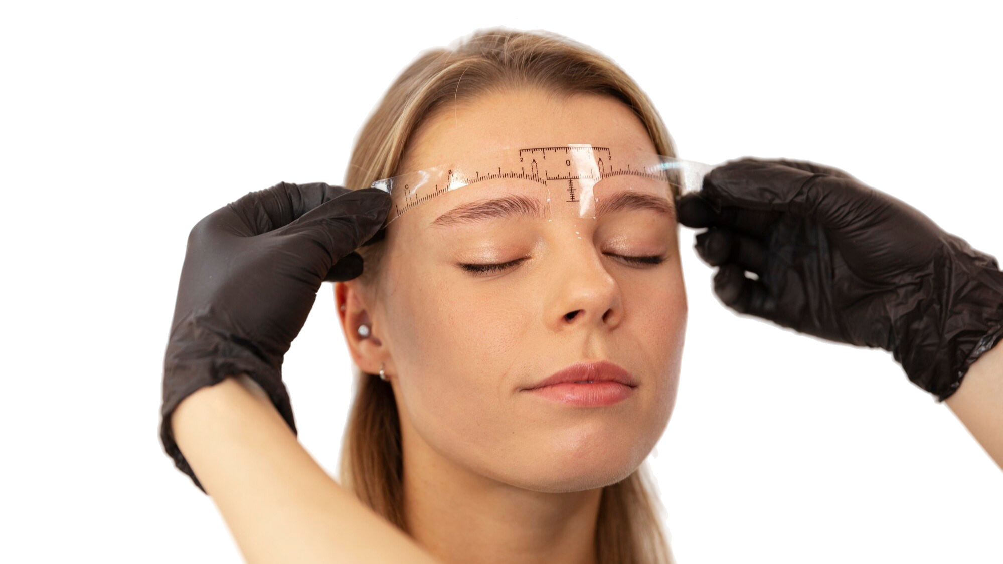 Brow Lift