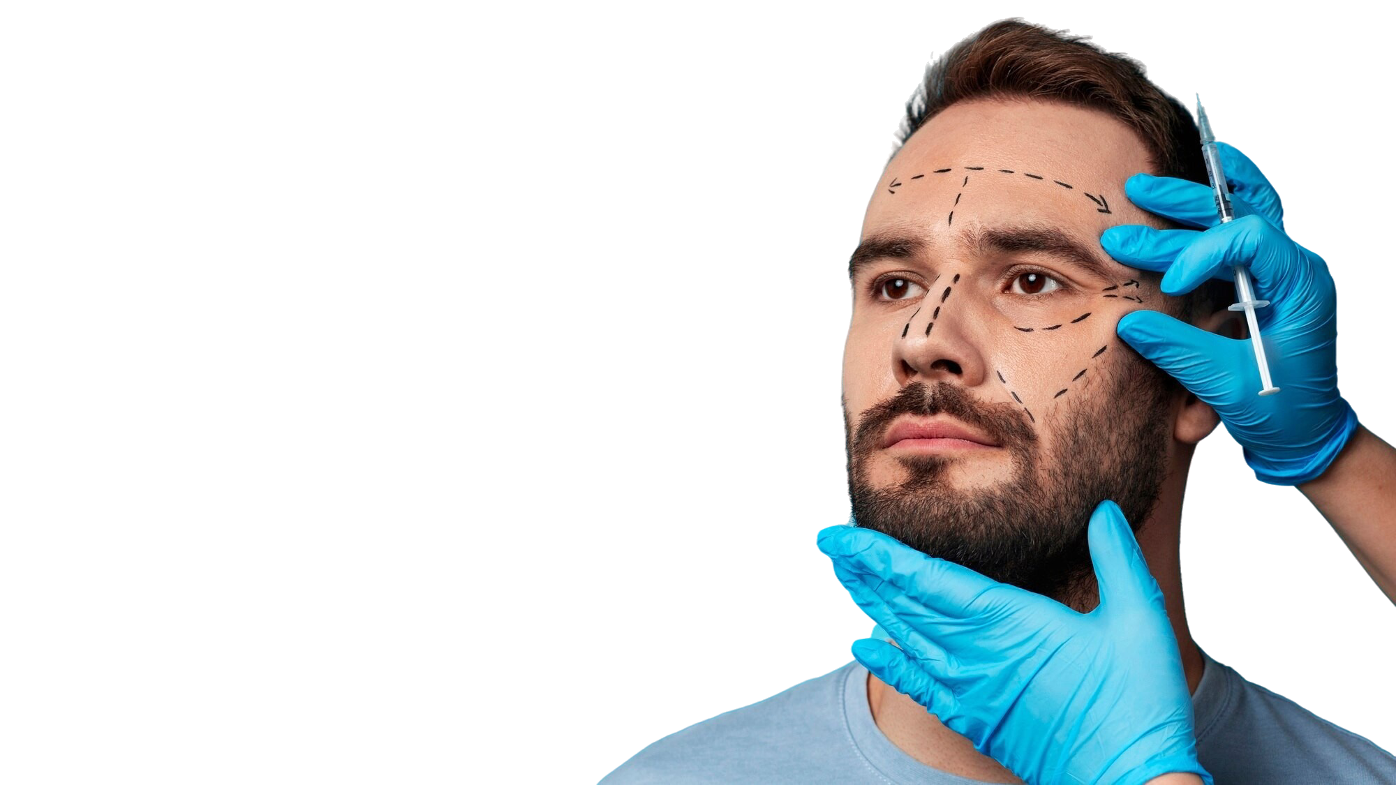 Facelift